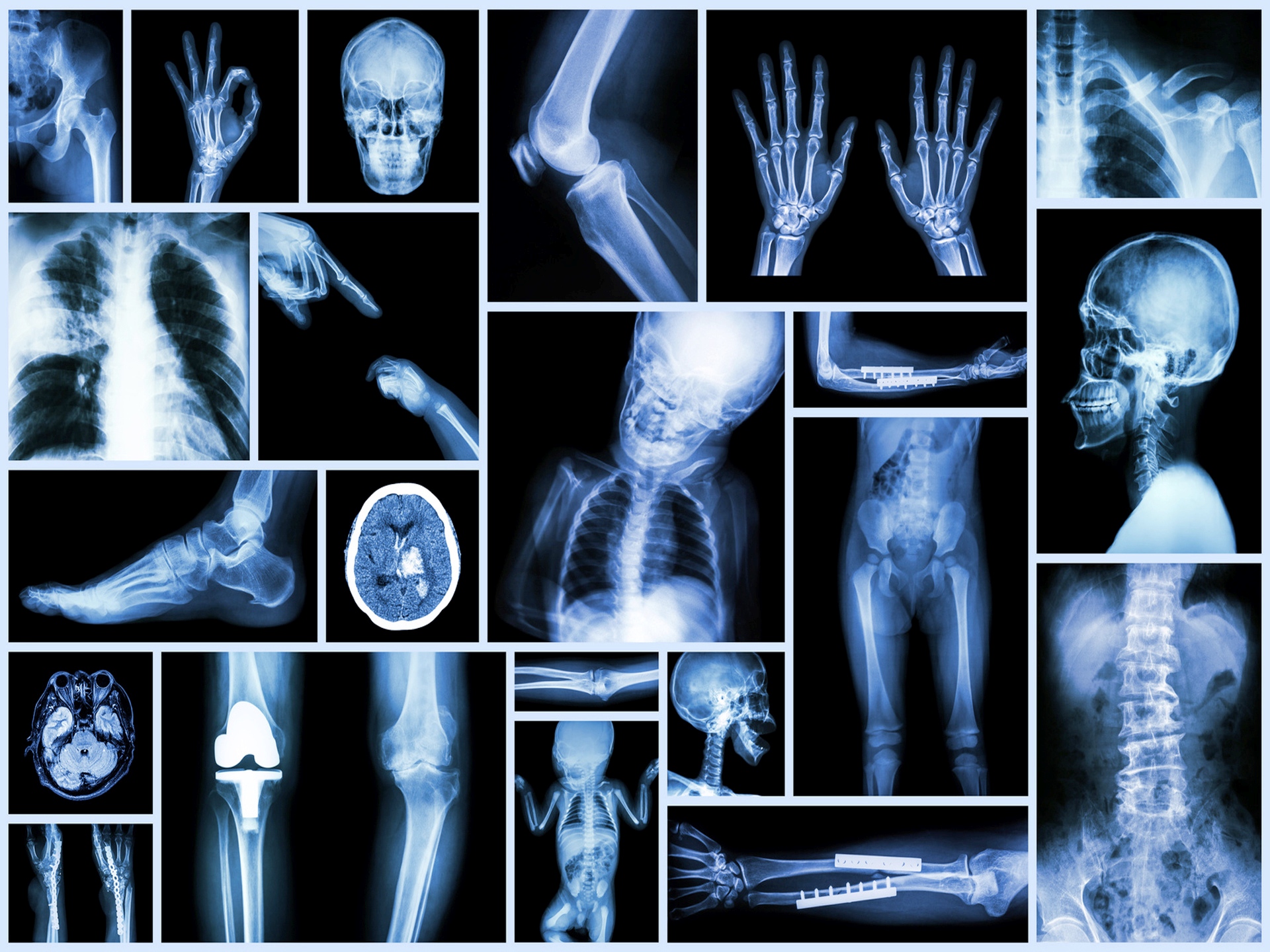 Alert: your child’s eye problem could be related to juvenile arthritis